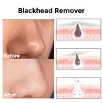 Dark Spot Corrector - Acne Control Cleanser - Makeup Remover