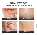 Dark Spot & Acne Soap Bar (Pack of 2)