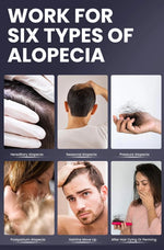 Hair Growth Serum/ SERUM ANTICAÍDA